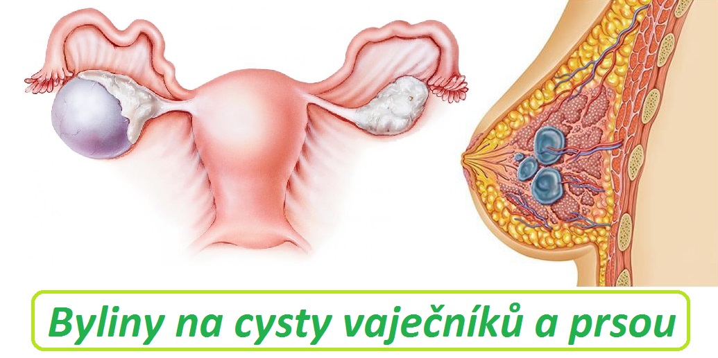 Cysty - byliny, bylinky, obklady, čajová směs na cysty vaječníku a prsou
