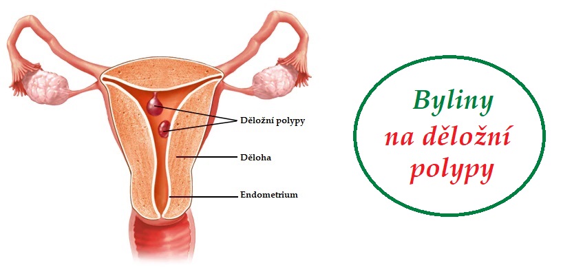 Polypy dělohy - byliny, bylinky, léčivé rostliny, léčba bez operace a léků